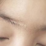 Narben in den Augenbrauen: Wie können Sie sie kaschieren?