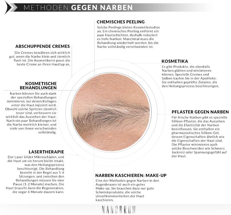 was hilft bei narben